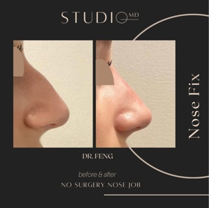 Post cover