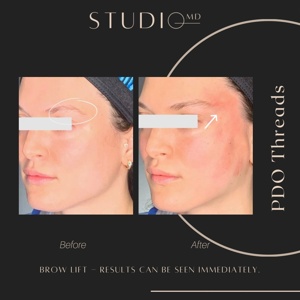 Post cover