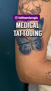 Post cover