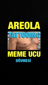 Post cover