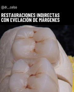 Post cover