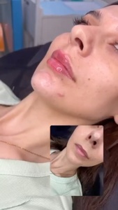 ...