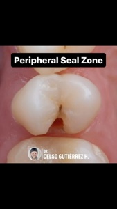 Post cover