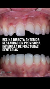 Post cover